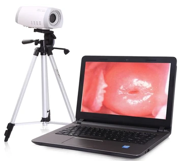 MCL300 הכי חסכוני דיגיטלי נייד וידאו colposcope המכשיר עם חצובה עבור גניקולוגיה